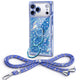Sparkle Stones Rhinestone Case Set | iPhone 18 Pro Max - Blue